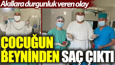 Akıllara durgunluk veren olay: Çocuğun beyninden saç çıktı