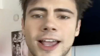 Dudaklarına dolgu yaptıran bir erkek sosyal medyada tepki topladı