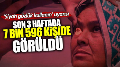 Siyah gözlük kullanın uyarısı! Son 3 haftada 7 bin 596 kişide görüldü