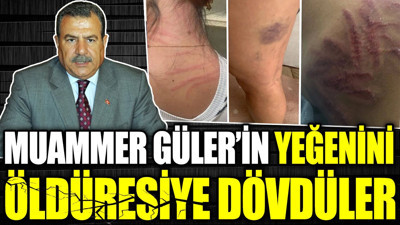 Muammer Güler’in yeğenini öldüresiye dövdüler