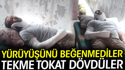 Yürüyüşünü beğenmediler tekme tokat dövdüler