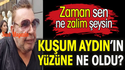 Kuşum Aydın'ın yüzüne ne oldu?
