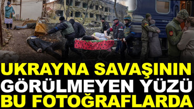 Ukrayna savaşının görülmeyen yüzü bu fotoğraflarda