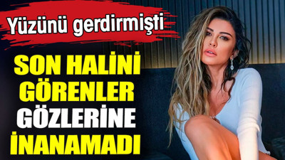 Yüzünü gerdirmişti. Son halini görenler gözlerine inanamadı