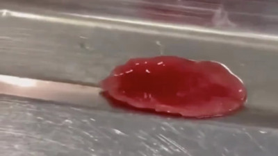 Vücuttan çıkarıldıktan sonra hareket eden parazitler şaşkınlık yarattı!