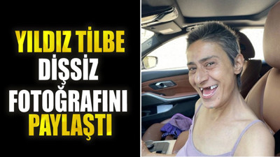 Yıldız Tilbe dişsiz fotoğrafını paylaştı