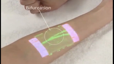 Cilt üzerinden damar görüntüleme teknolojisi: Tıpta yenilikçilik