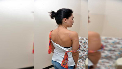 Dövmeyi sakın yanlış silmeyin! Büyük tehlikeler ortaya çıktı. Uzmanlardan hayat kurtaran uyarılar