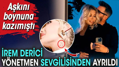İrem Derici yönetmen sevgilisinden ayrıldı. Aşkını boynuna kazımıştı