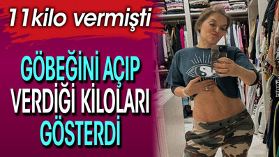 11 kilo veren Demet Akalın göbeğini açıp verdiği kiloları gösterdi