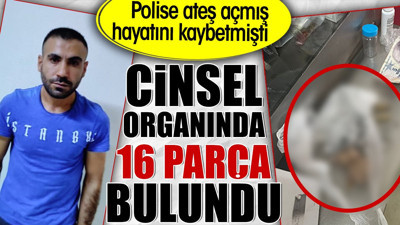 Cinsel organında 16 parça bulundu. Polise ateş açmış hayatını kaybetmişti