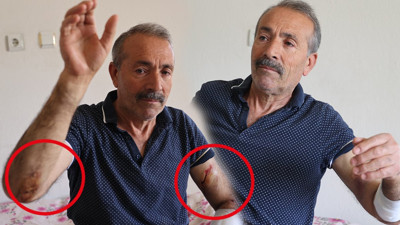 Ekmek almak için fırına giderken köpekler saldırdı