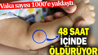 48 saat içinde öldürüyor. Vaka sayısı 1000'e yaklaştı
