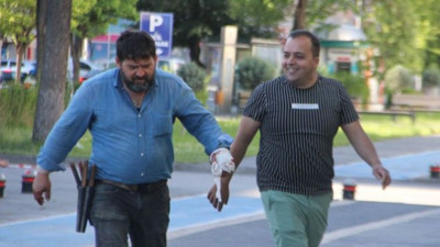 Kayseri’de 437 acemi kasap hastanelik oldu