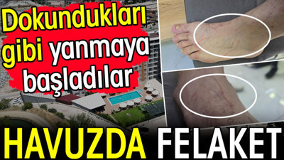 Yüzme havuzunda felaket! Dokundukları gibi yanmaya başladılar