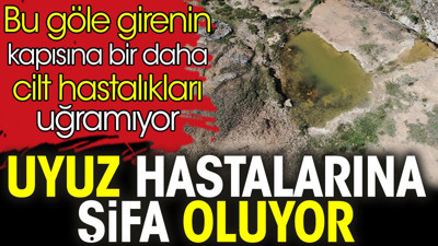 Uyuz hastalarına şifa oluyor. Bu göle girenin kapısına bir daha cilt hastalıkları uğramıyor