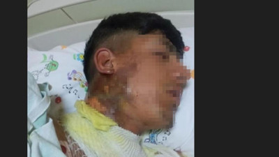 Çoban kardeşleri yıldırım çarptı