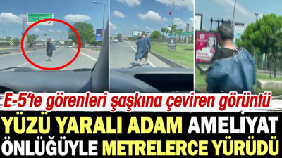E-5'te görenleri şaşkına çeviren görüntü! Yüzü yaralı adam ameliyathane önlüğüyle metrelerce yürüdü