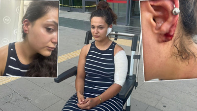 Haber takibi yapan DHA muhabiri Zehra Baykal’a saldırı! Kulağına 7 dikiş atıldı