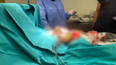 14 yaşındaki çocuğun midesinden çıkanlar şoke etti! Doktorlar bile neye uğradığını şaşırdı