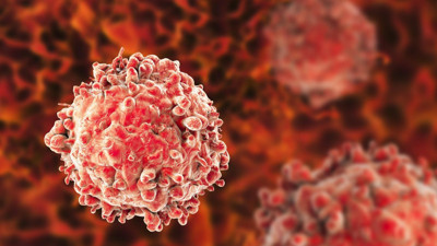 Çağımızın ölümcül hastalığı lösemi nedir?