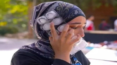 Yüzüne kızgın yağ döküldü... MasterChef Beyza apar topar hastaneye kaldırıldı! İlk açıklama geldi