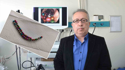 Bursa’da görülmemiş olay: Bağırsağından 38 adet mıknatıslı boncuk çıkartıldı