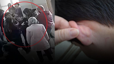 Özel eğitim okulunda şiddet skandalı! Otizmli öğrenciye darp olayına soruşturma