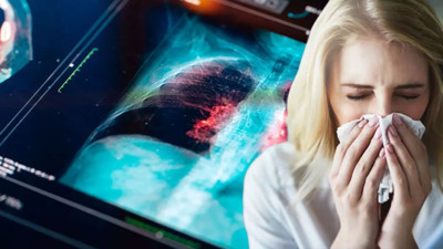 Yoğun bakımlar doldu taştı! 3 gün süren bu belirtilere dikkat