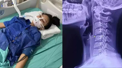 Boyun ağrısı için masaja gitti canından oldu!