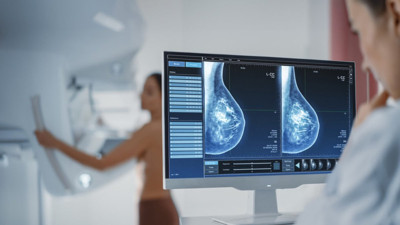 Meme kanseri teşhisinde yapay zekâ devrimi