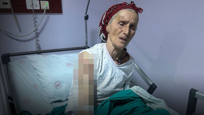 Yaşlı kadına 7 köpek dehşeti yaşattı: Vücuduna tam 50 dikiş atıldı!