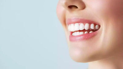 Hollywood gülüşüyle ilgili uzmanlardan kritik uyarılar