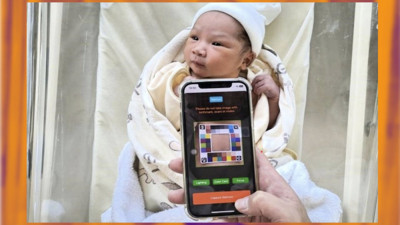 Yenidoğan sarılığı tespitinde yeni dönem