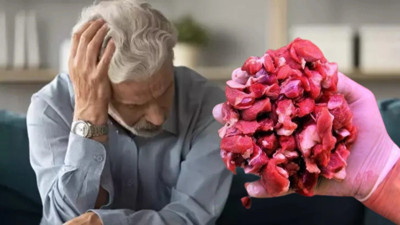 Bilimsel çalışmalar gösterdi: Aşırı işlenmiş kırmızı et tüketimi demansa yol açabilir