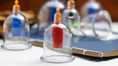 Hacamat yaptıranlar dikkat! Ömür boyu sürebilir