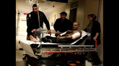 Dengesini kaybetti! Ağaç soyma makinesine kollarını kaptırdı