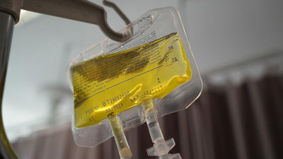 Sağlık Bakanlığı'ndan sarı serum uyarısı