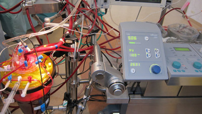 Kalp ve akciğer cihazları, hayat kurtarabilir mi? Uzmanlar anlatıyor