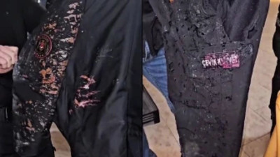 Yerlikaya: Bir polis memurumuza asit atıldı