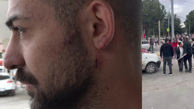 Kavgayı ayırmak isterken kulağından ısırıldı! O anlar anlatı