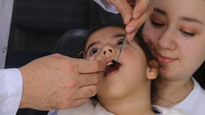 Diş çürüklerine peynir freni! İşte mucize formül