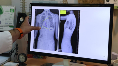 Ergenlikte yaşanan büyük tehlike alarm veriyor! Uzmanlar konuştu