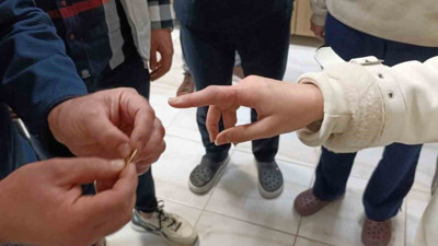 Parmağına yüzük sıkışınca hastanelik oldu!