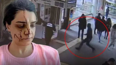 Genç kadını tanınmaz hale getirmişti... Sanıktan akılalmaz istek!