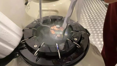 Tüp bebekte yapay zeka devrimi