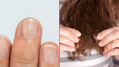 Görünmez düşman vücudunuzu yavaş yavaş eritiyor! Uzmanlar uyardı