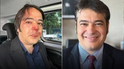 Kaçak kafeleri yıkarken saldırıya uğramıştı! İBB İmar Daire Başkanı Ramazan Gülten'in ifadesi ortaya çıktı...