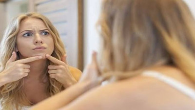 Sivilceye son verecek aşı! Akne tedavisinde tarihi adım