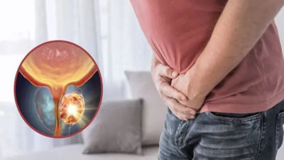 Kanseri yakalayan test! İdrarınız hayat kurtarabilir